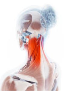 Nackenmuskulatur häufig zu stark beansprucht-min